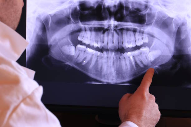 Best Cracked Tooth Emergency Dentist  in Niagara Falls, NY